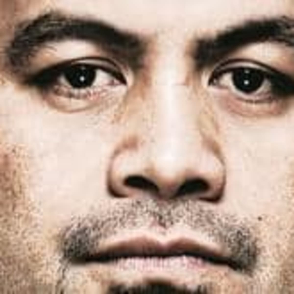 Former UFC heavyweight champion Fabricio Werdum has eyelid 'ripped