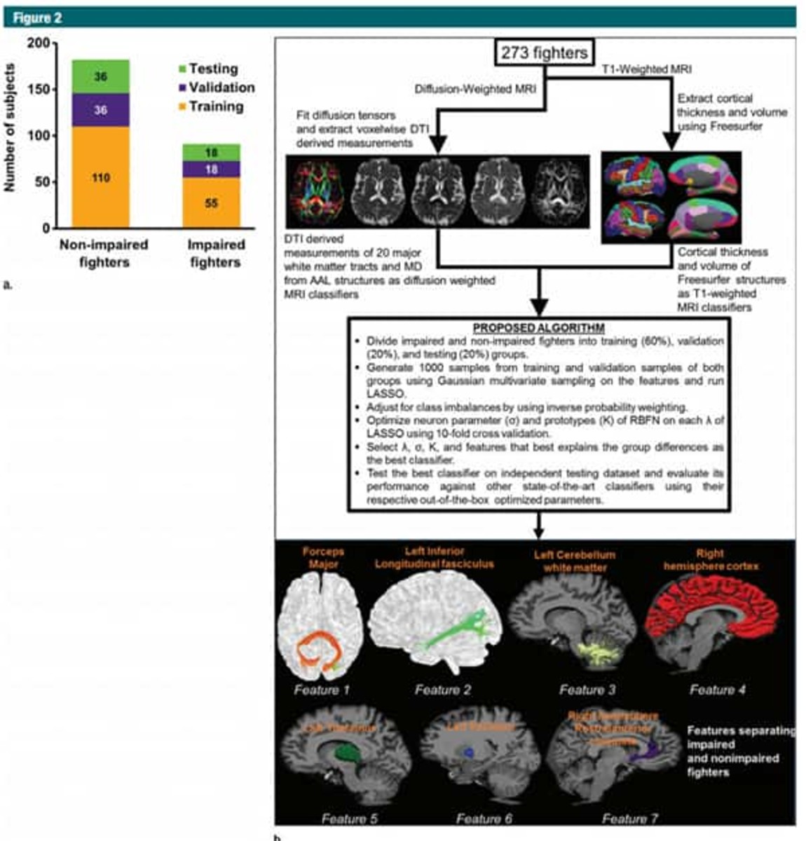 MRI study shows promise tracking fighter brain damage - MMA Underground