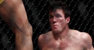 Anderson Silva: Chael has learned his lesson
