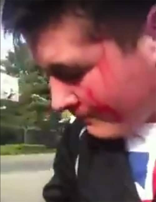 Bully picks fight against kid with boxing skills – learns lesson quickly