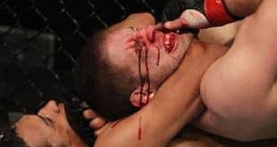 Charles Oliveira: Pennsylvania AC was too hard on me