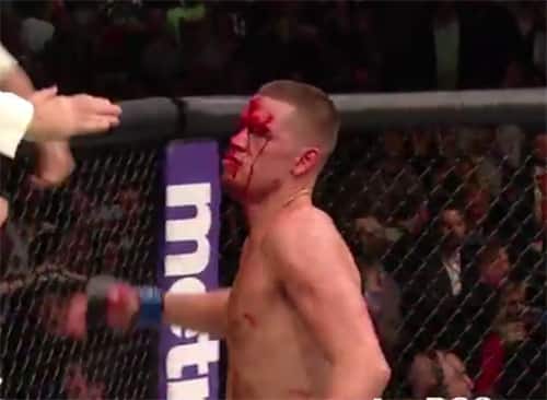 McGregor’s family and girlfriend react to loss at UFC 196