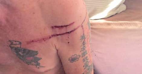 Man credits boxing classes with saving his life against black bear