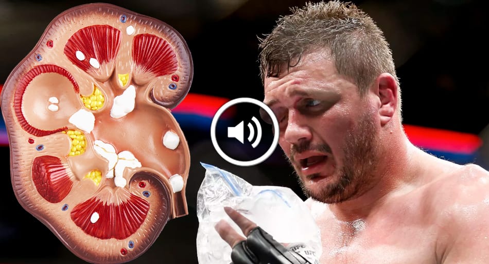Mitrione suffers horrific eye injury at UFC Boston