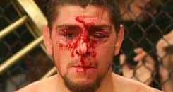 Nick Diaz vs. Joe Riggs II set for Strikeforce 8/15