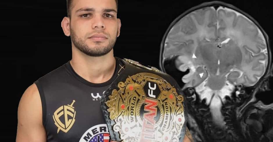 Rudson Caliocane plans return 1 year after brain hemorrhage