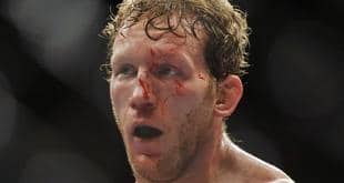 Seven UFC on FX 4 medical suspensions