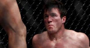 Sonnen: The knee hit me in the face, AND it was fair play