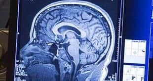 Study: More educated fighters getting less CTE