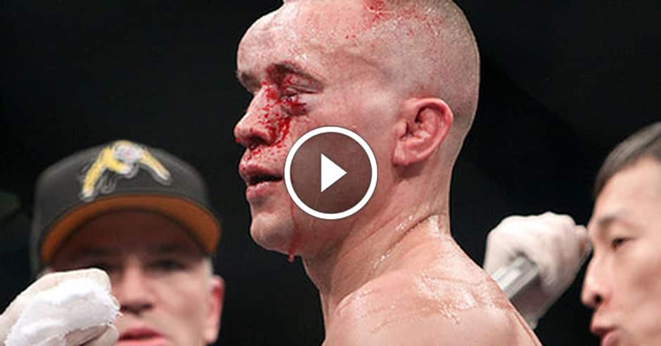 Top 5 most horrific post-fight faces