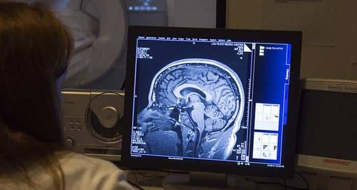 Biomarkers could help identify CTE risk