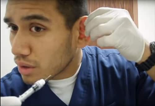 UFC fighter shows you how to drain your own cauliflower ear