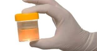 UFC institutes formal written drug policy