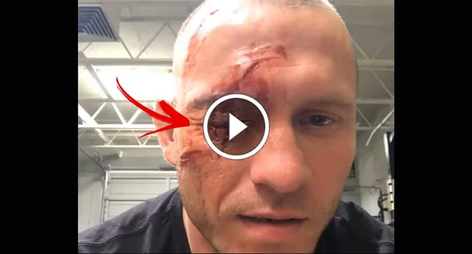 WTF happened to this UFC fighter?